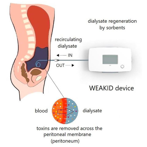 WEAKID schematic